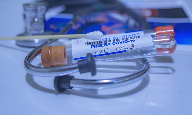 RBP vyčlení 2 miliony korun jako příspěvek na 20 tisíc PCR testů na Karvinsku